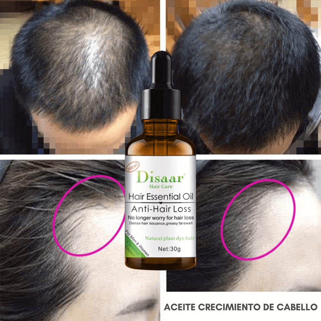 Aceite Profesional Anticaída y Crecimiento - Recupera tu confianza
